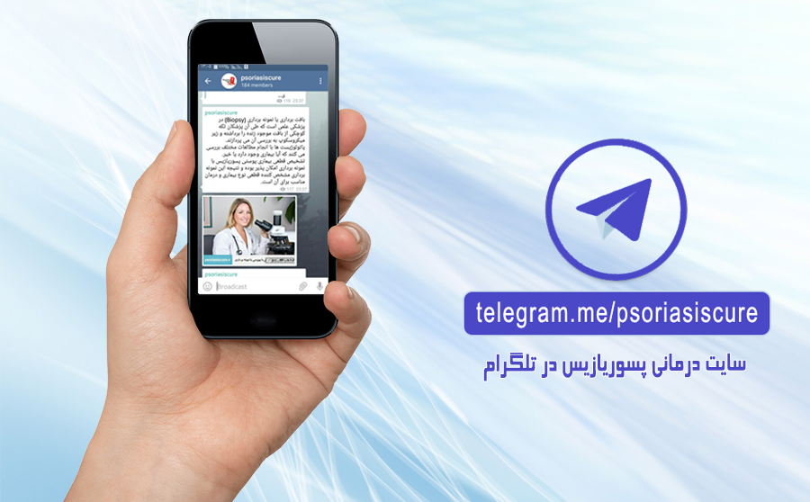 کانال رسمی سایت درمانی پسوریازیس در تلگرام