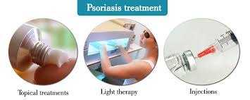 ایمن‌ترین و موثرترین درمان برای پاک کردن پسوریازیس کدام درمان  است؟