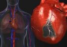 کمک برخی از داروهای پسوریازیس به پیشگیری از بیماری های قلب