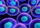 نقش سلول های بنیادی در درمان بیماری پسوریازیس